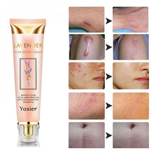 Lade das Bild in den Galerie-Viewer, MUZXR- Skin Care Extractors Lavender Scar Repair Cream Repairing Burn Scars Skin Care 20g HZP