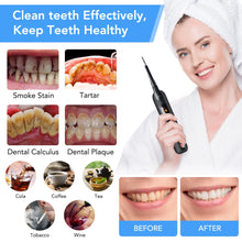 Load image into Gallery viewer, Electric Sonic Dental Scaler For Whiten Teeth Tartar Cleaner Tooth Calculus Remover Tool Kit